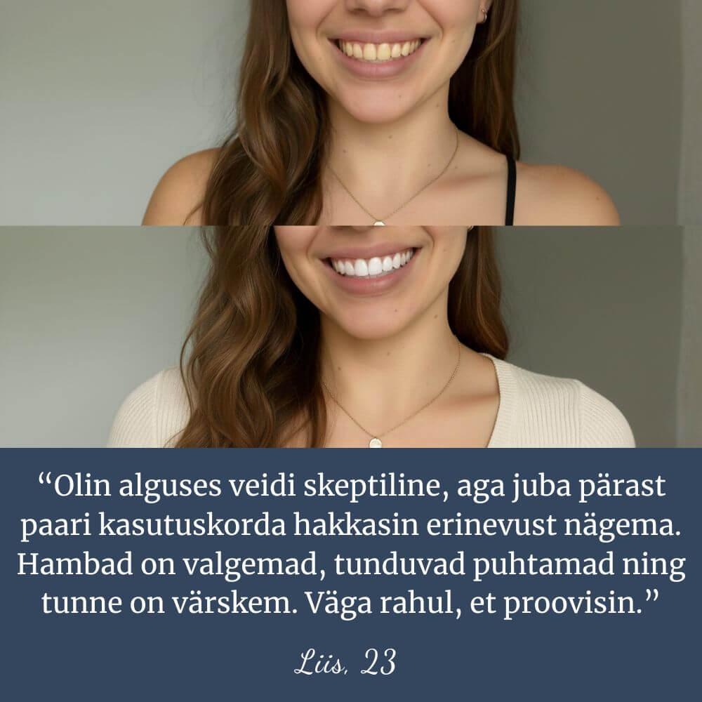 Hammaste valgendusribad